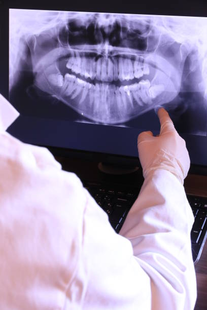 Best Emergency Tooth Extraction in Panhandle, TX