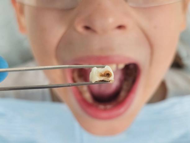 Best Emergency Denture Repair in Panhandle, TX
